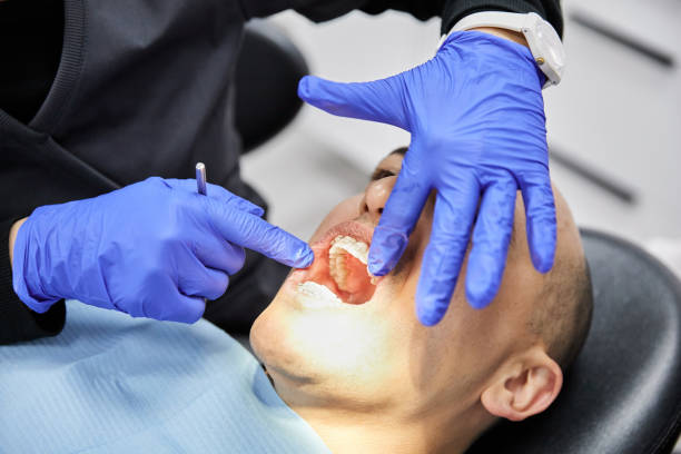 Best Emergency Treatment for Dental Infections or Abscesses in Crandon, WI